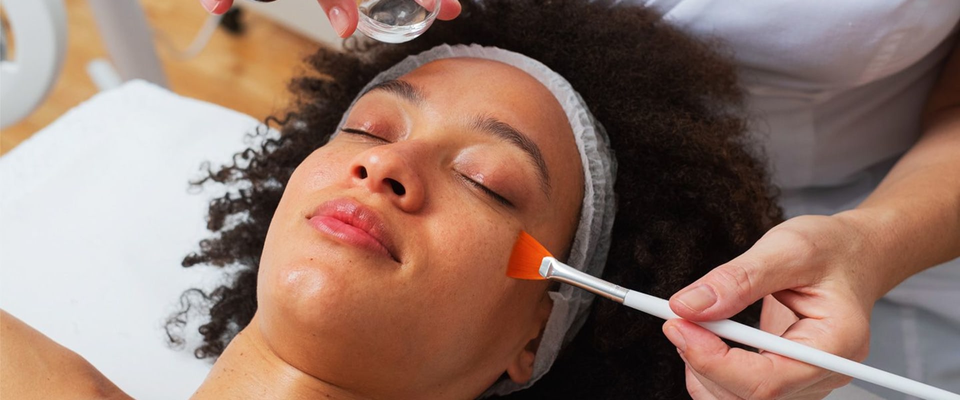 Chemical Peels: A Comprehensive Overview