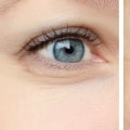 Reduced Appearance of Wrinkles and Fine Lines: A Comprehensive Overview