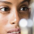 Facial Acne Treatments: What to Know