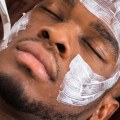 Men's Skin Care Treatments: A Comprehensive Overview