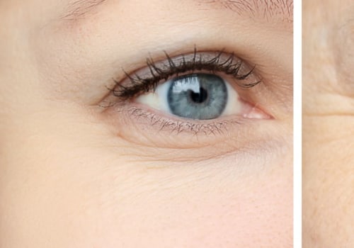 Reduced Appearance of Wrinkles and Fine Lines: A Comprehensive Overview