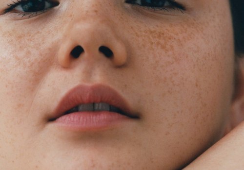 Facials: A Comprehensive Overview
