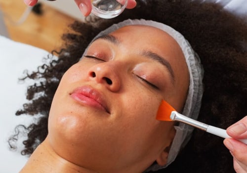 Chemical Peels Treatments: A Comprehensive Overview