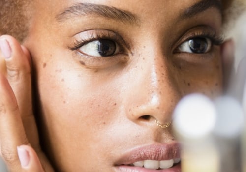 Facial Acne Treatments: What to Know