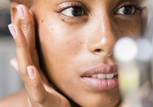 Acne Facial Treatments: A Comprehensive Overview