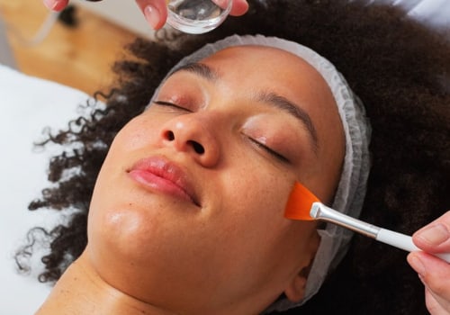 Chemical Peels: A Comprehensive Overview
